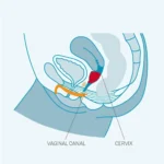 menstrual-silikon-regli-kabi-20-ml